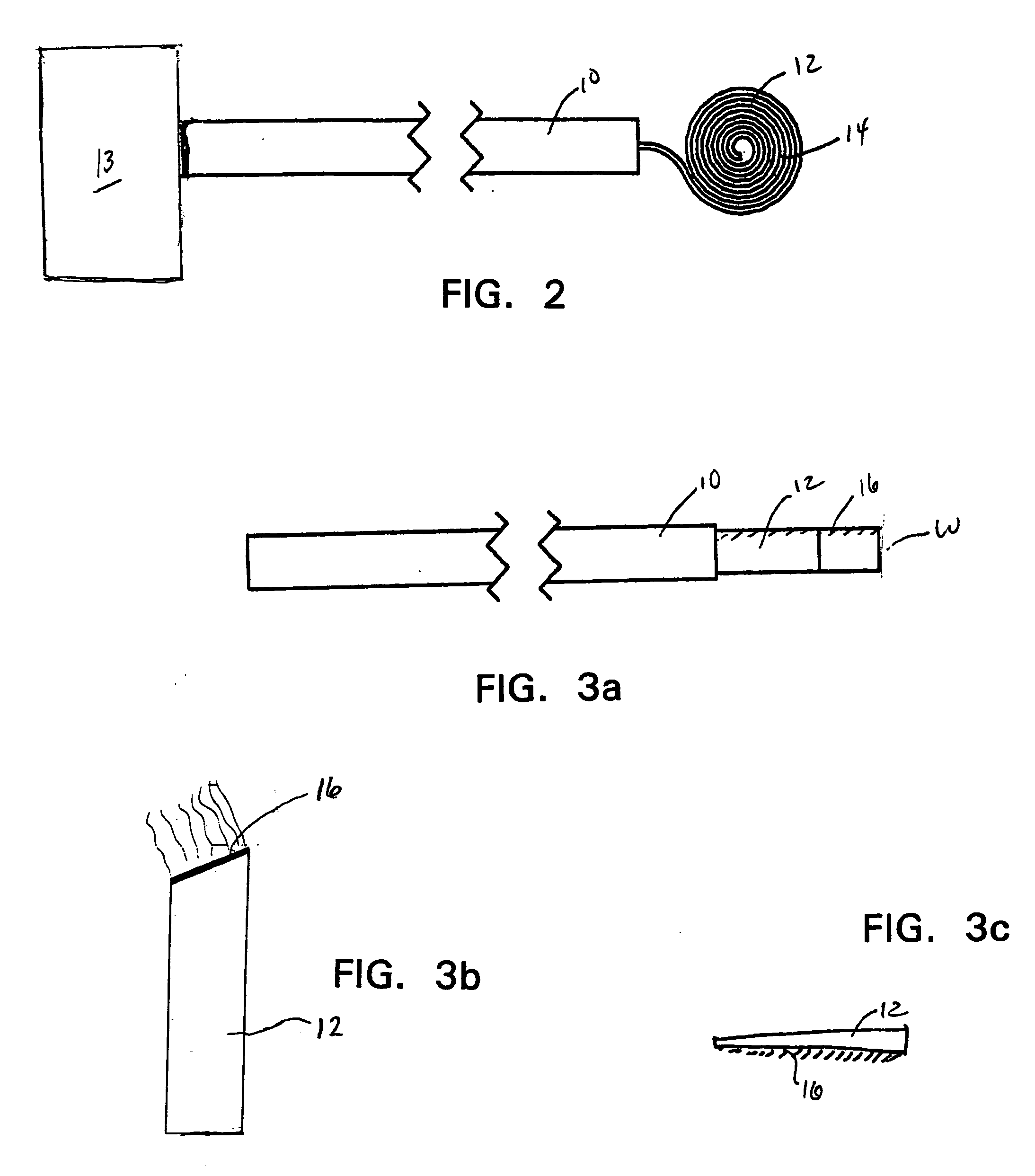 Intraocular brachytherapy device and method