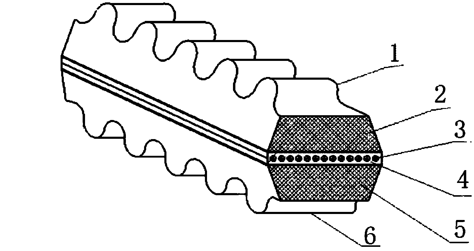 Production technology of double-surface clipping V-shaped band
