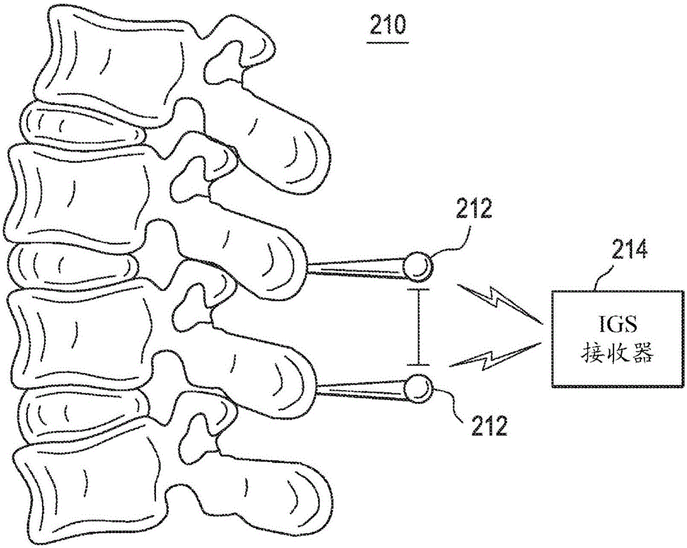 Methods and devices for spinal correction