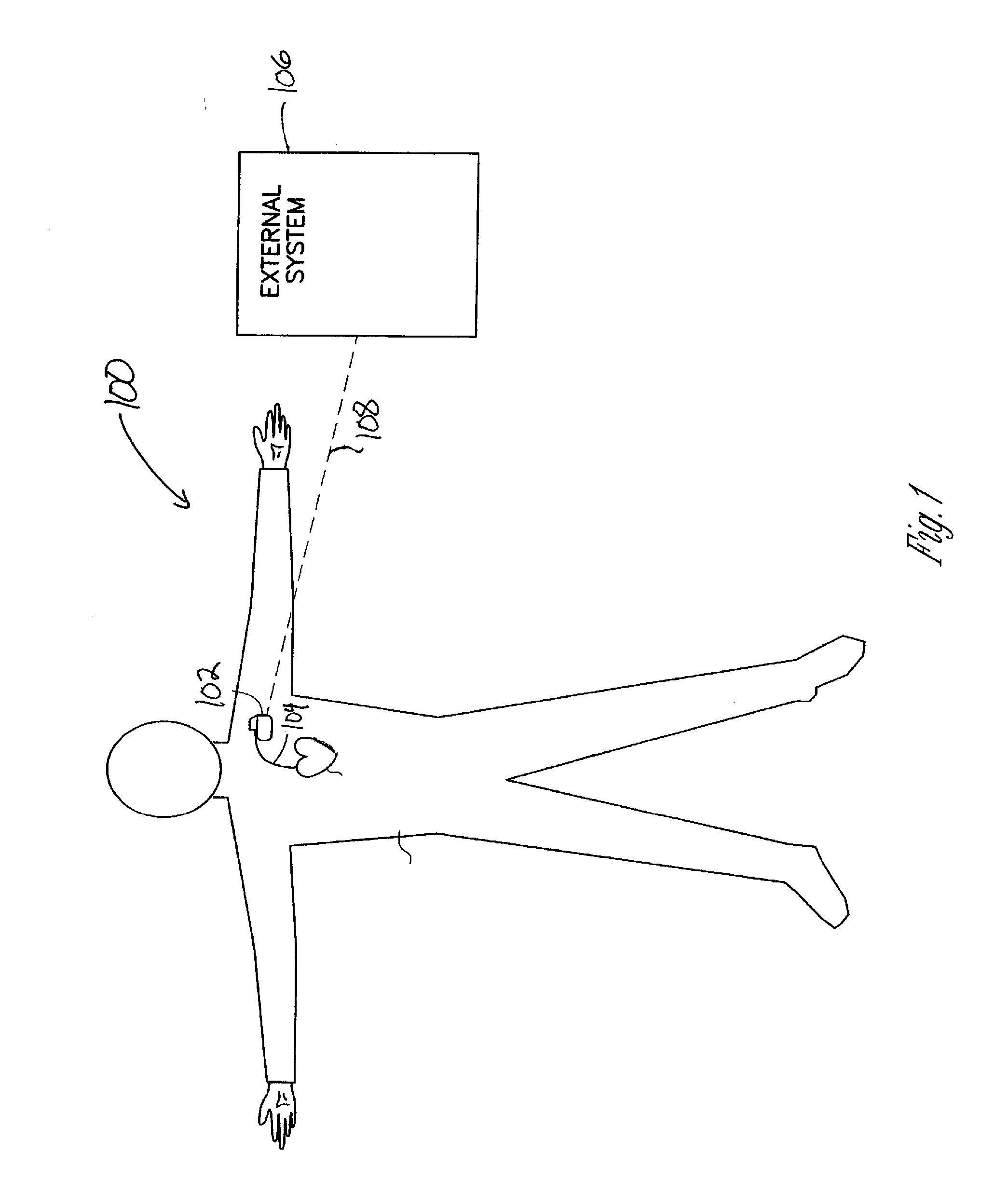 Physiological event detection systems and methods