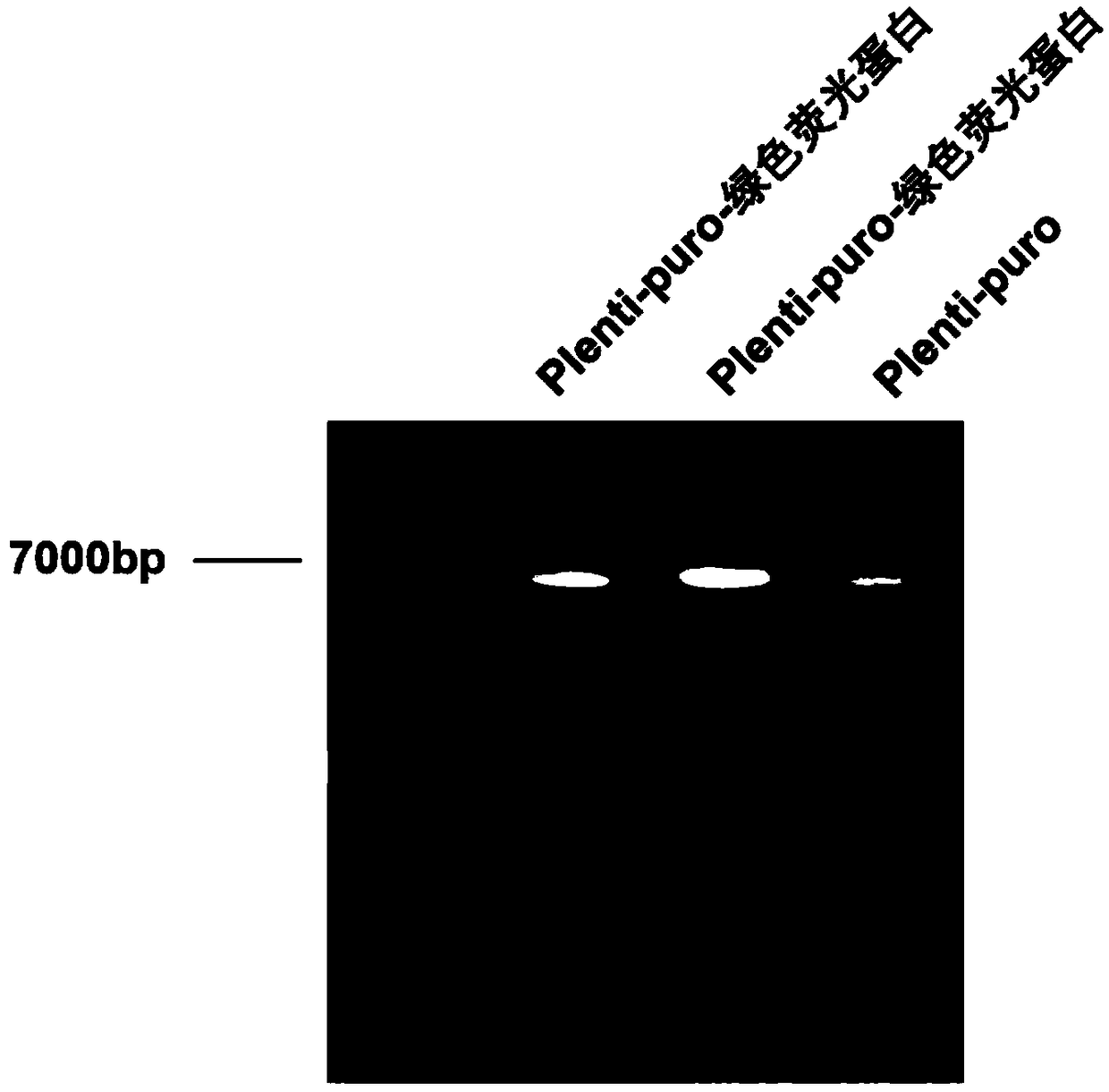 Method for constructing laryngeal cancer cell line for stably expressing green fluorescent protein