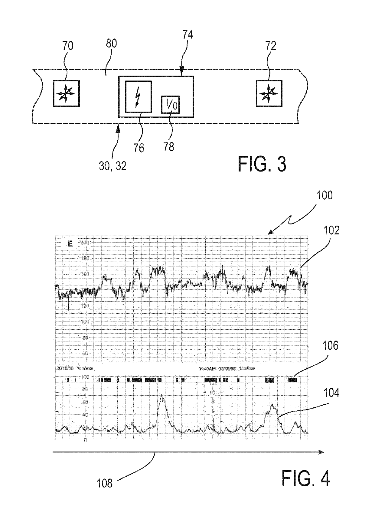 Pregnancy monitoring system and method