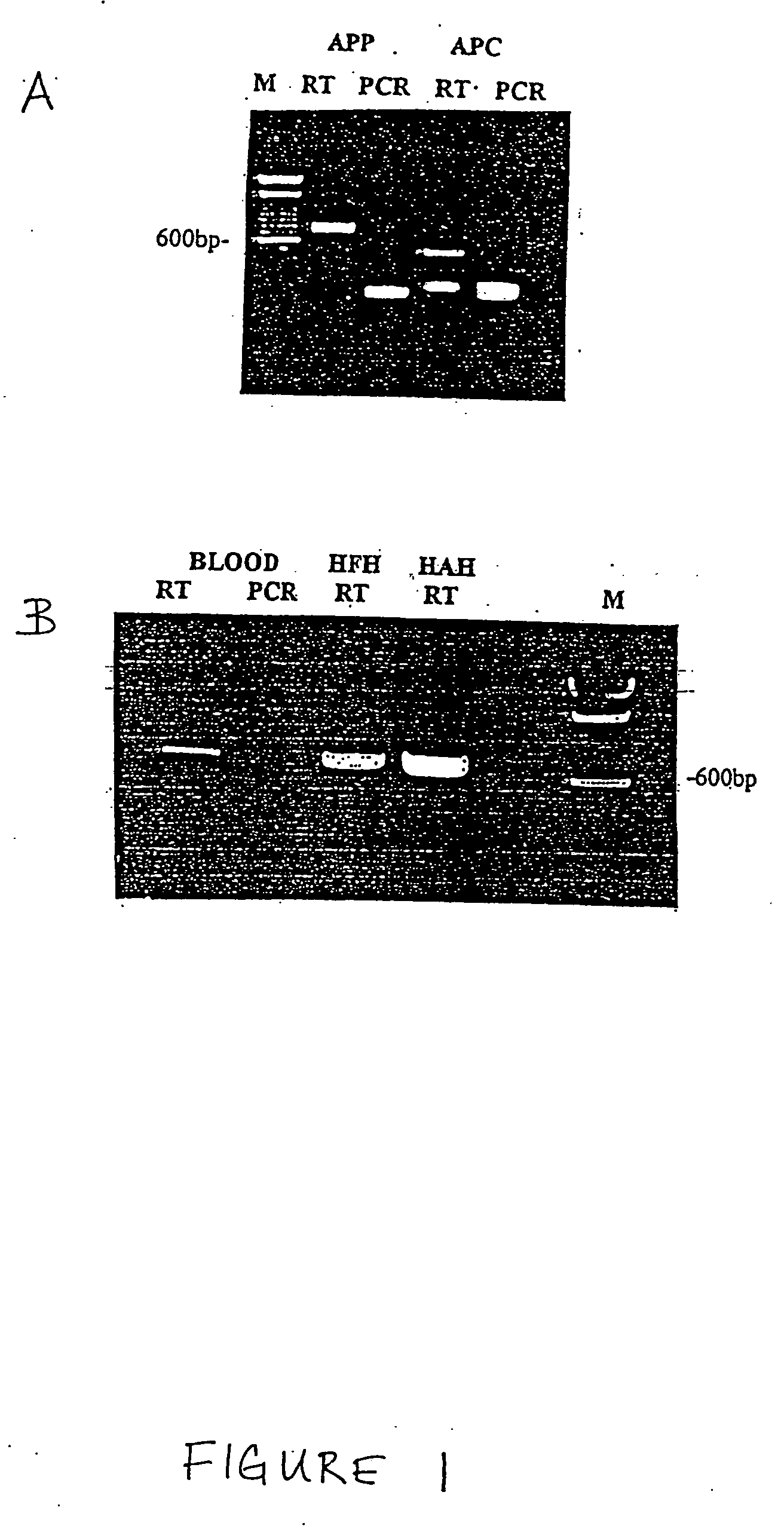 Method for the detection of schizophrenia related gene transcripts in blood
