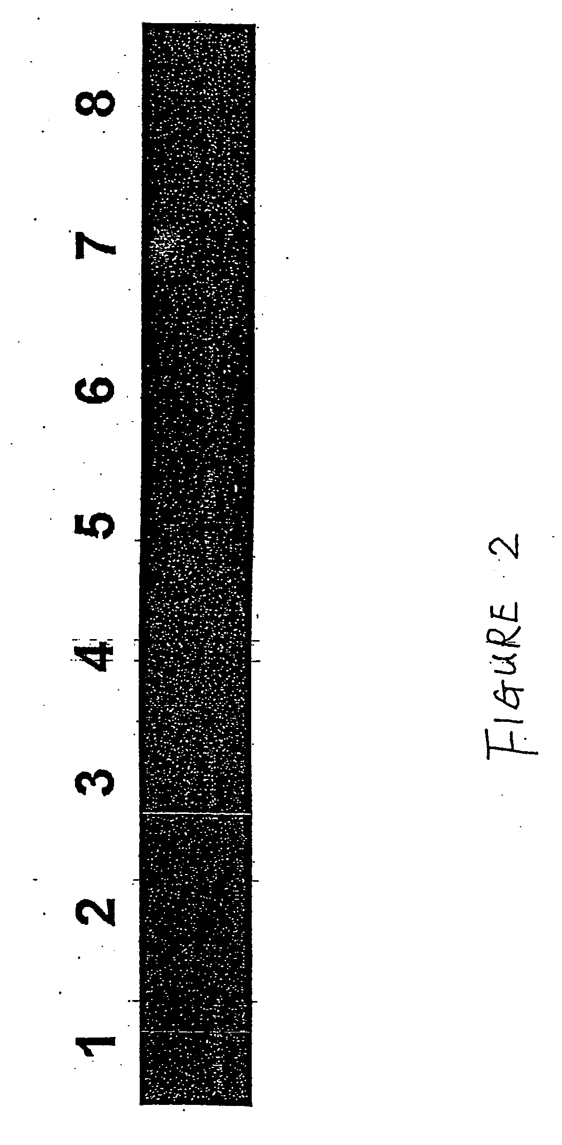 Method for the detection of schizophrenia related gene transcripts in blood