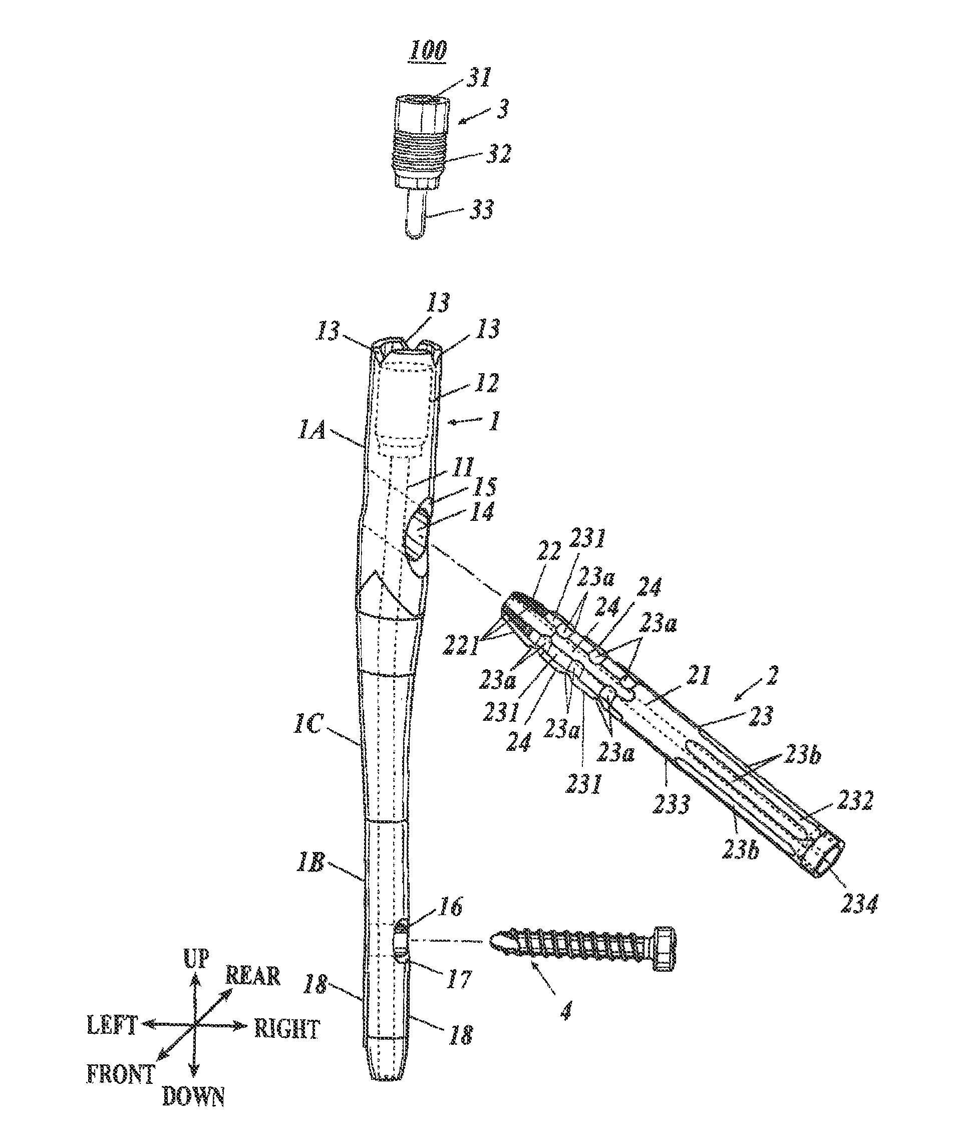 Bone Fixing Material and Thighbone Fixing System
