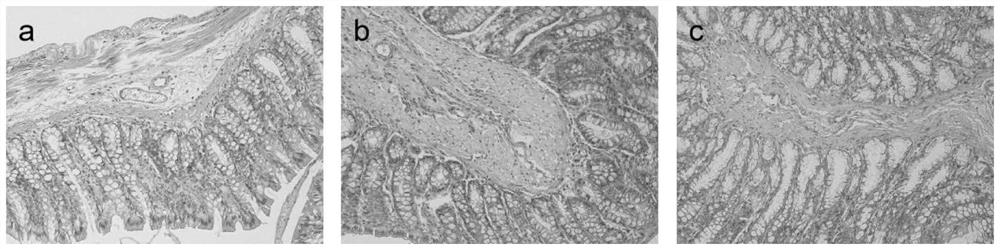 Lactobacillus plantarum capable of relieving irritable bowel syndrome and application of lactobacillus plantarum