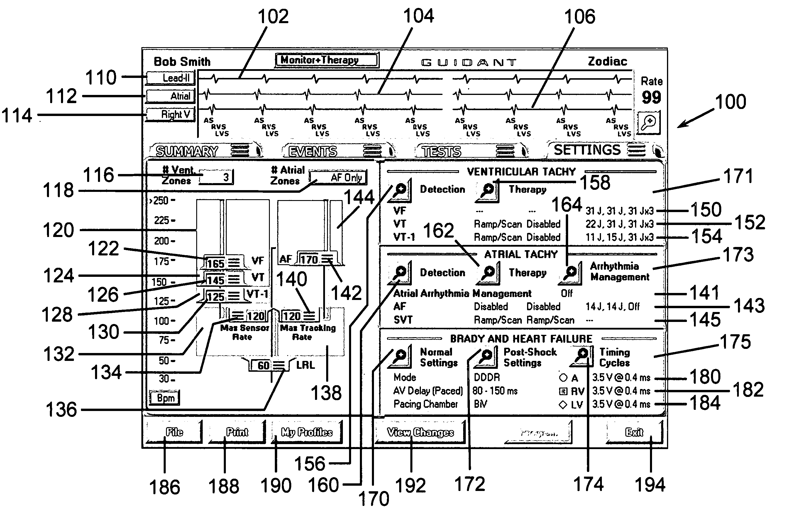 Medical device interface system and method
