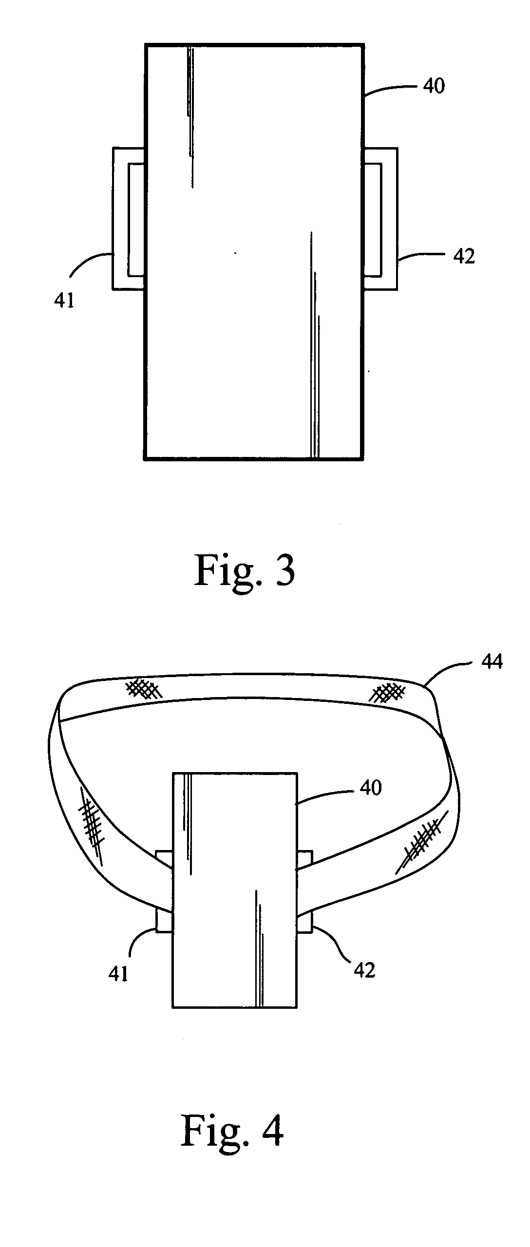 Partially implantable system for the electrical treatment of cancer