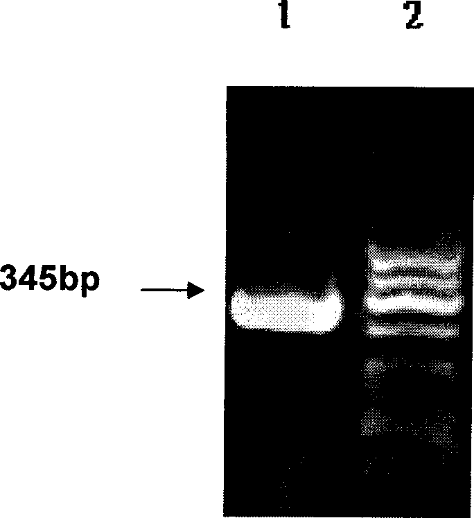 Epididymal protease inhibitor protein monoclonal antibody and application thereof