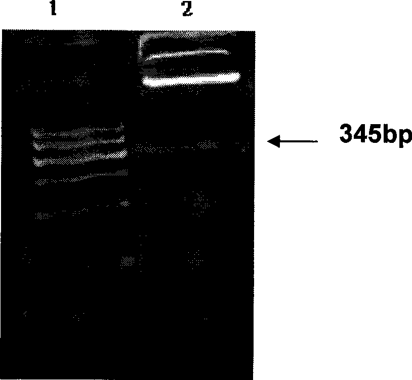 Epididymal protease inhibitor protein monoclonal antibody and application thereof