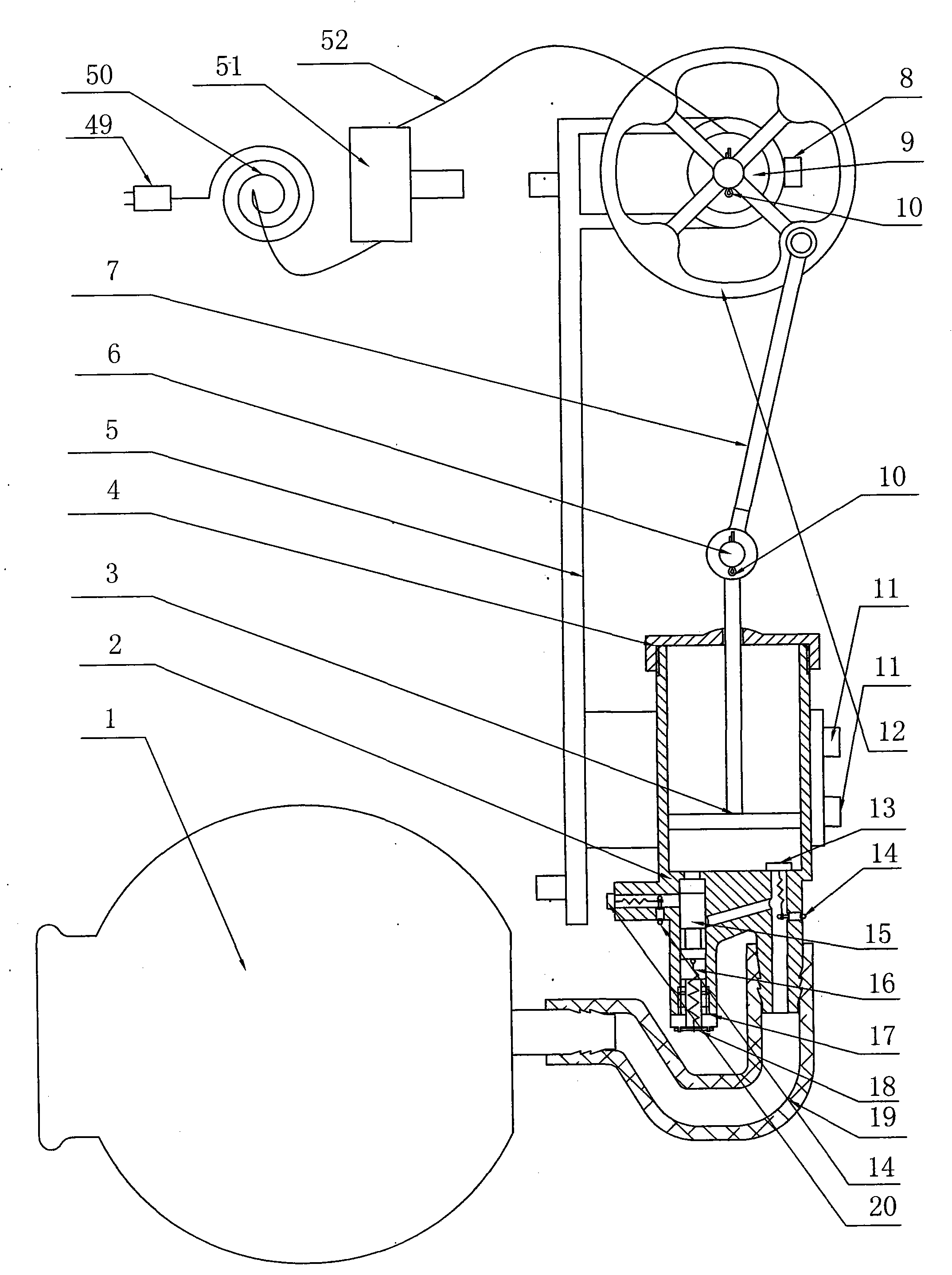 Pulse variable-pressure cupping device