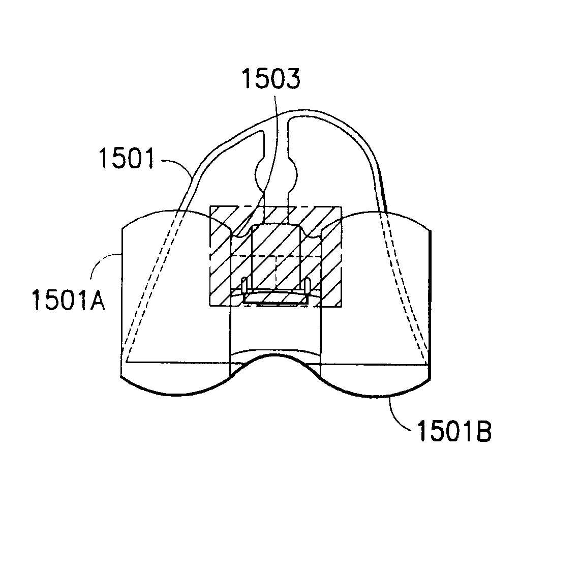 Systems and methods relating to a knee prosthesis capable of conversion from a cruciate retaining type prosthesis to a posterior stabilizng type prosthesis