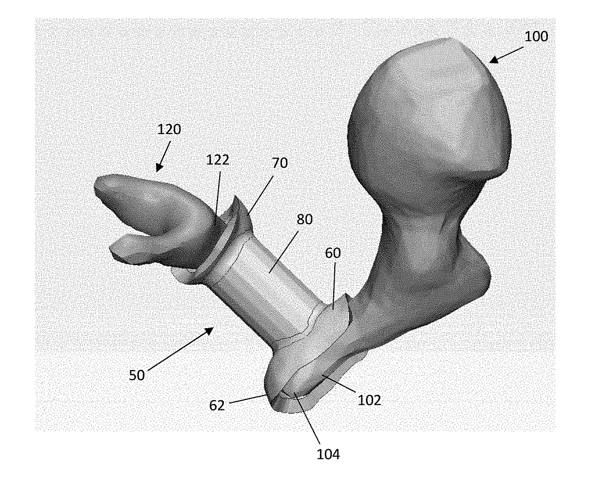 Ossicular prosthesis and method and system for manufacturing same