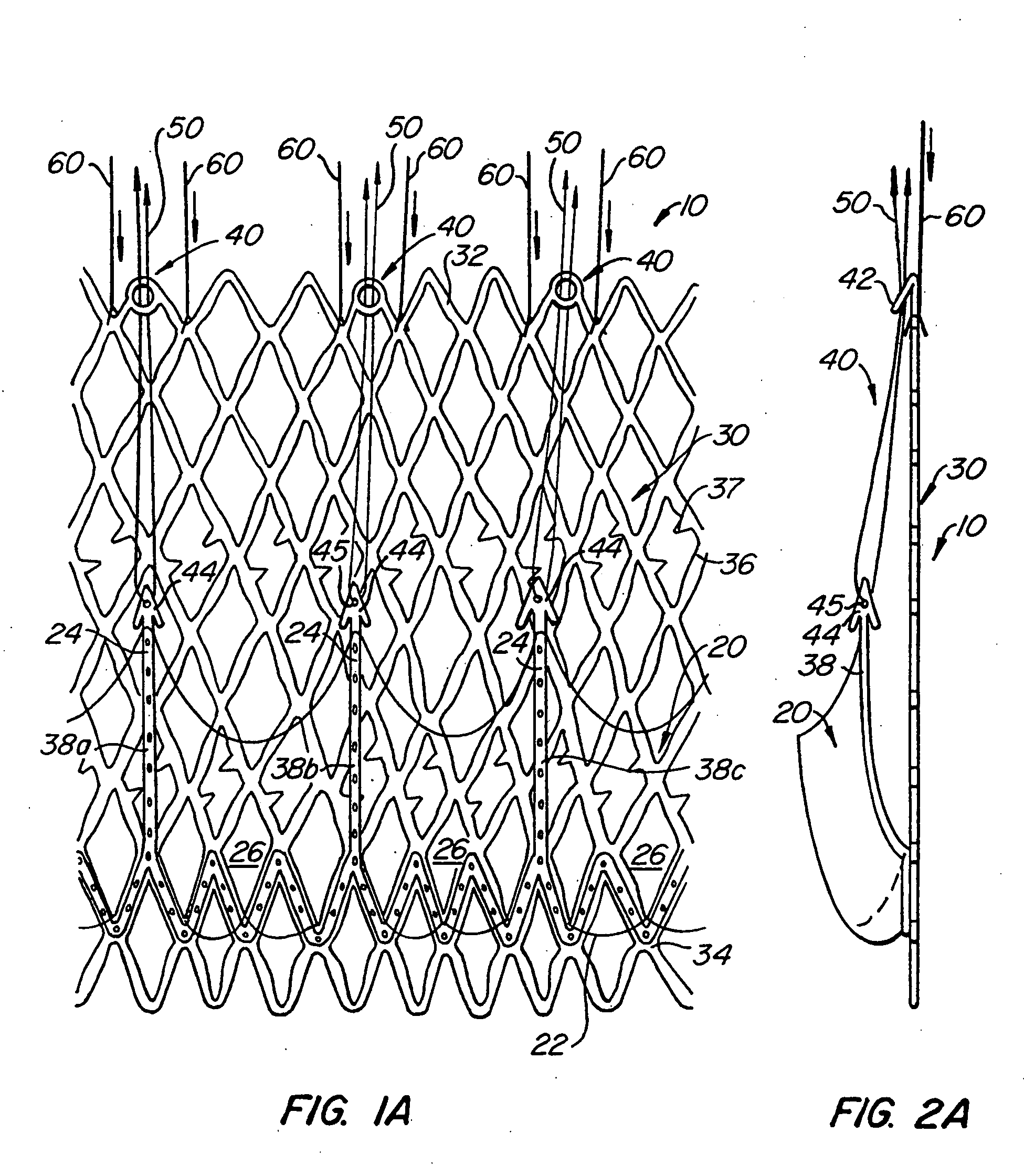Repositionable heart valve and method