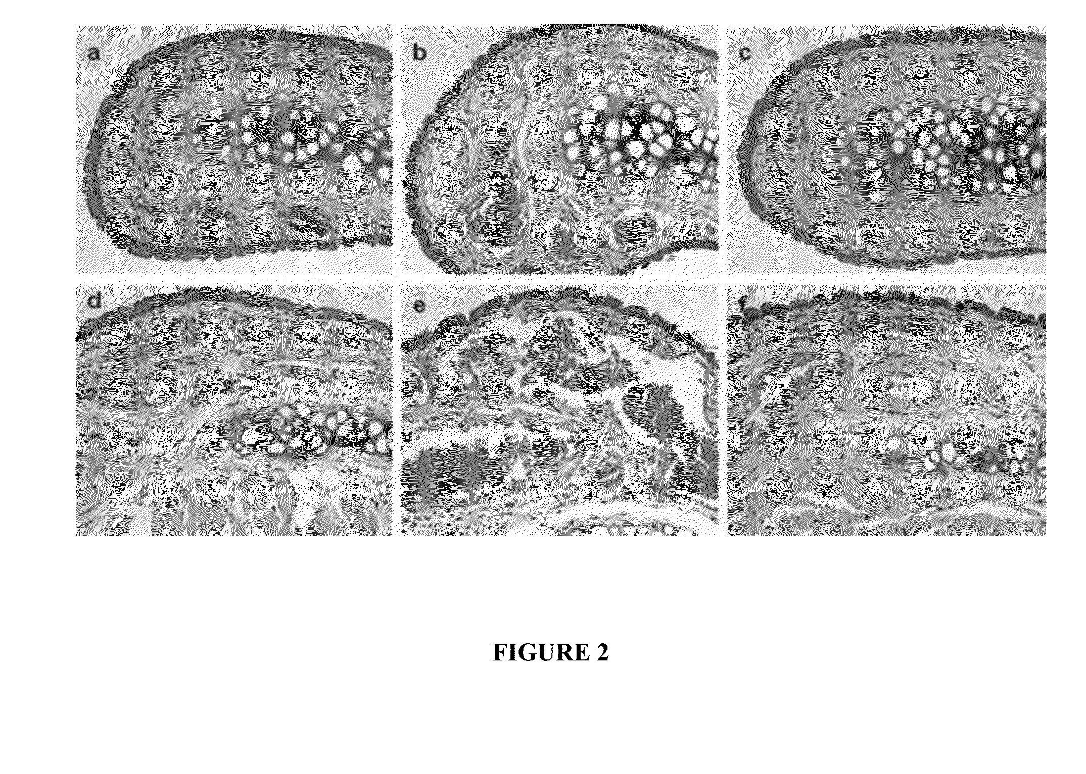 Compositions and Methods for Safe Treatment of Rhinitis