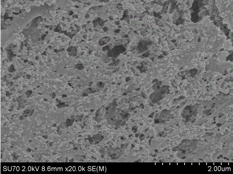 Preparation method of medical metal implant surface embedded with chitosan microsphere collagen coating