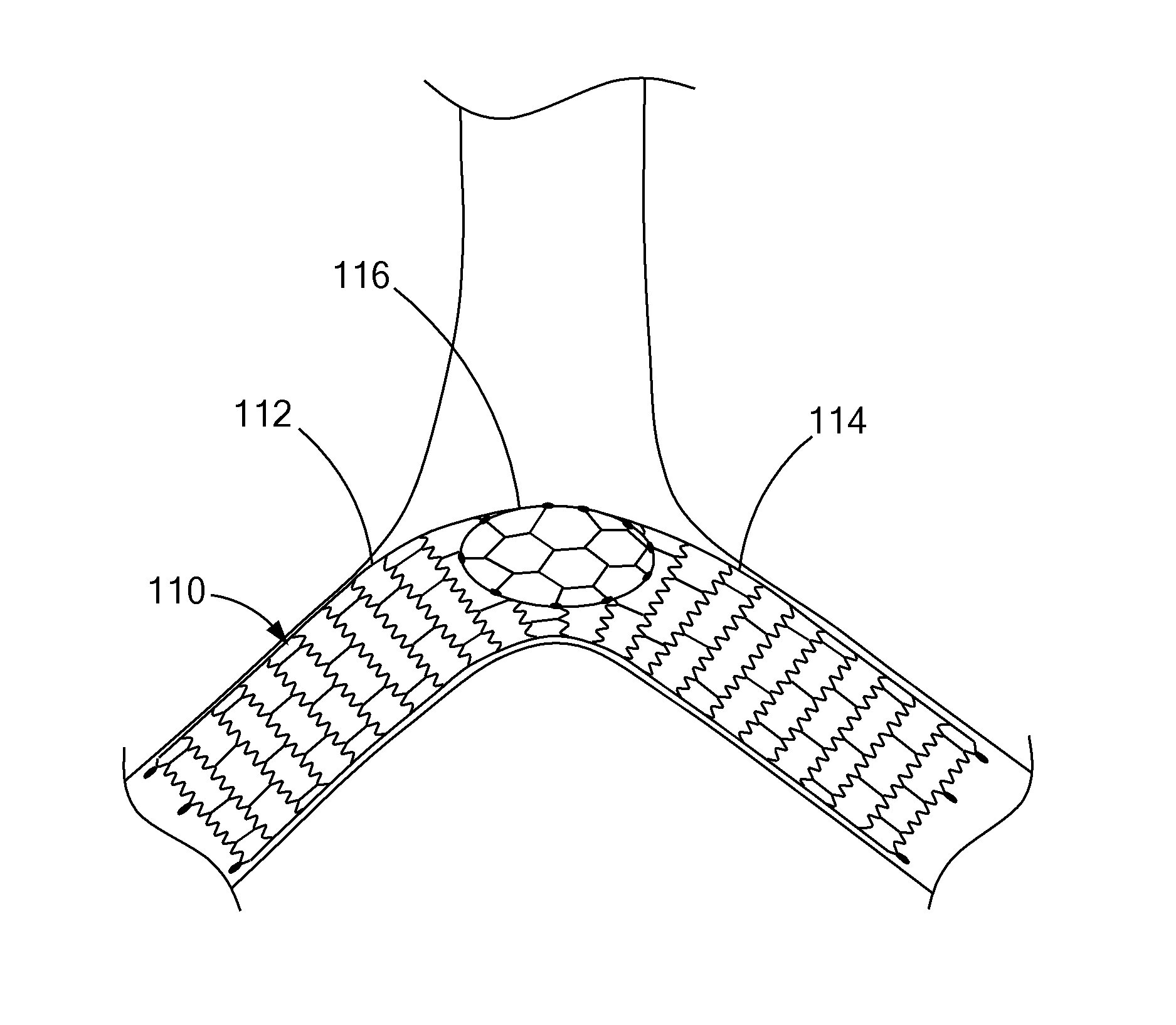 Frame-based vena cava filter