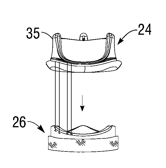 Systems and methods for rapidly deploying surgical heart valves