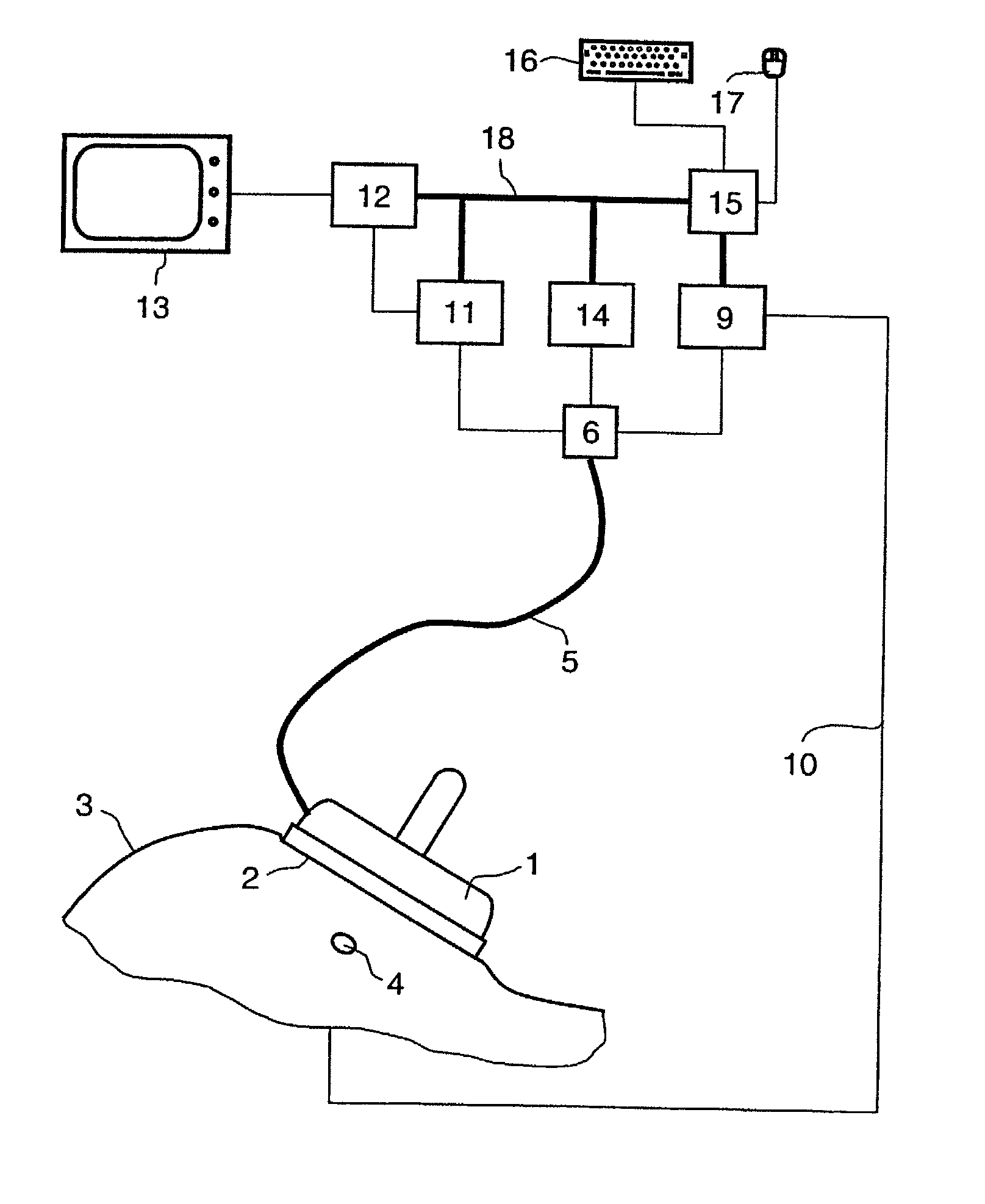 Measurement system for examining a section of tissue on a patient and the use of a measurement system of this type