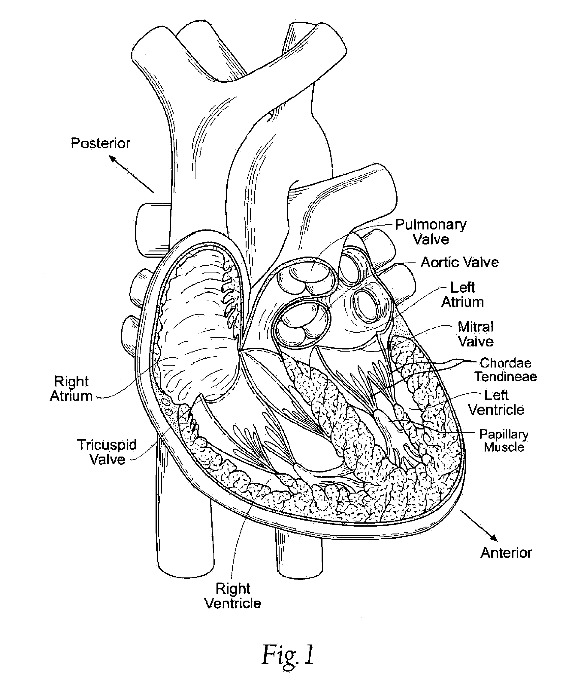 Unitary quick connect prosthetic heart valve and deployment system and methods