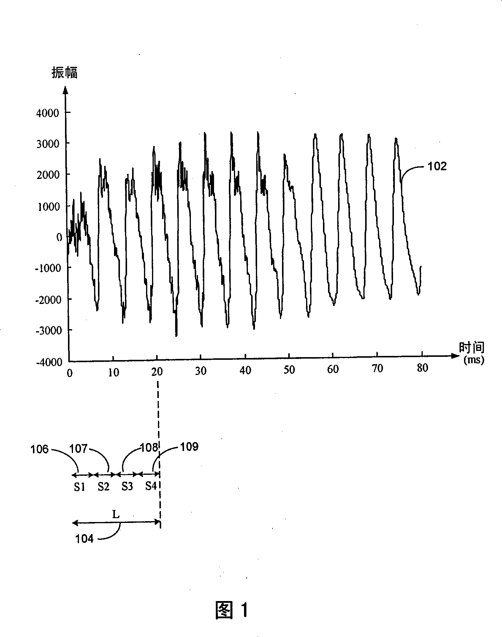 Dual-transform coding of audio signals