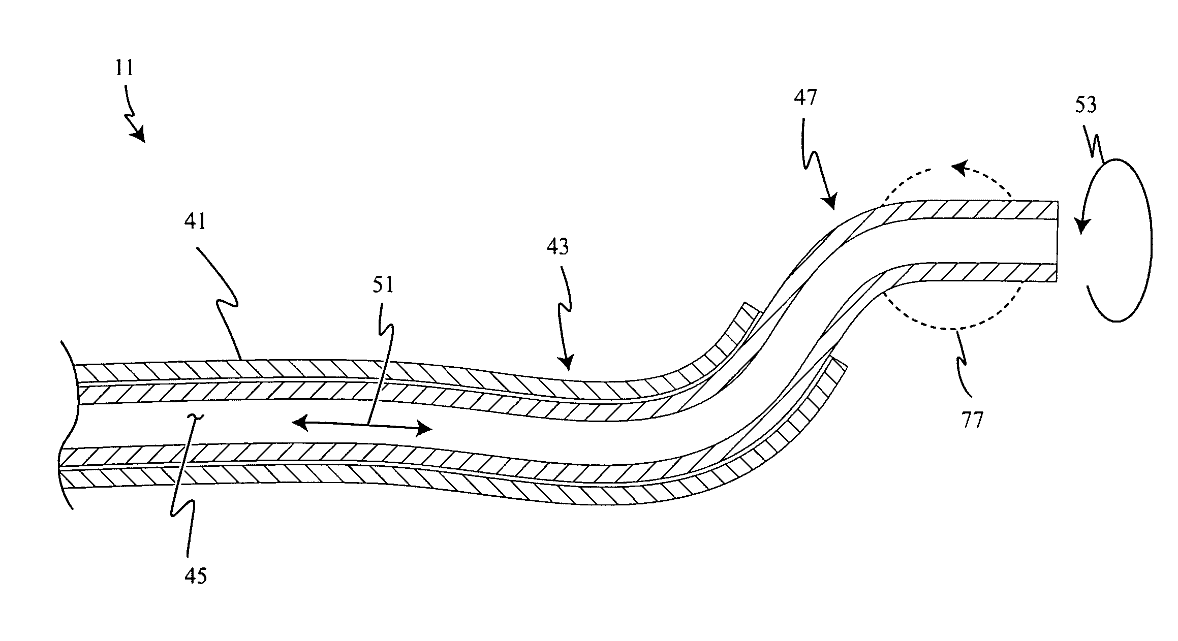 Endotracheal tube and stylet