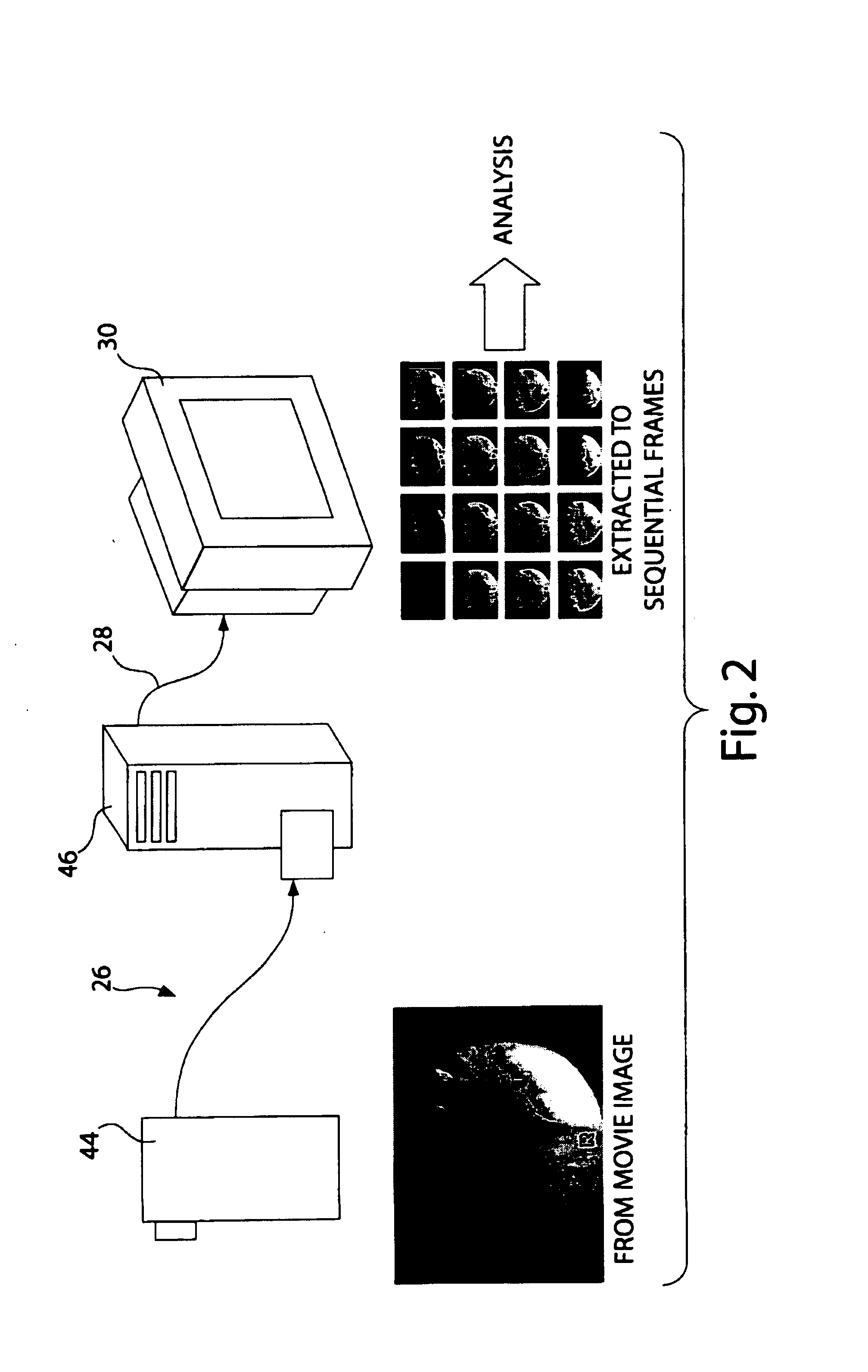 Apparatus and method for the kinetic analysis of tear stability
