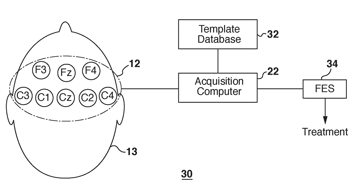 Method and system for brain activity signal-based treatment and/or control of user devices