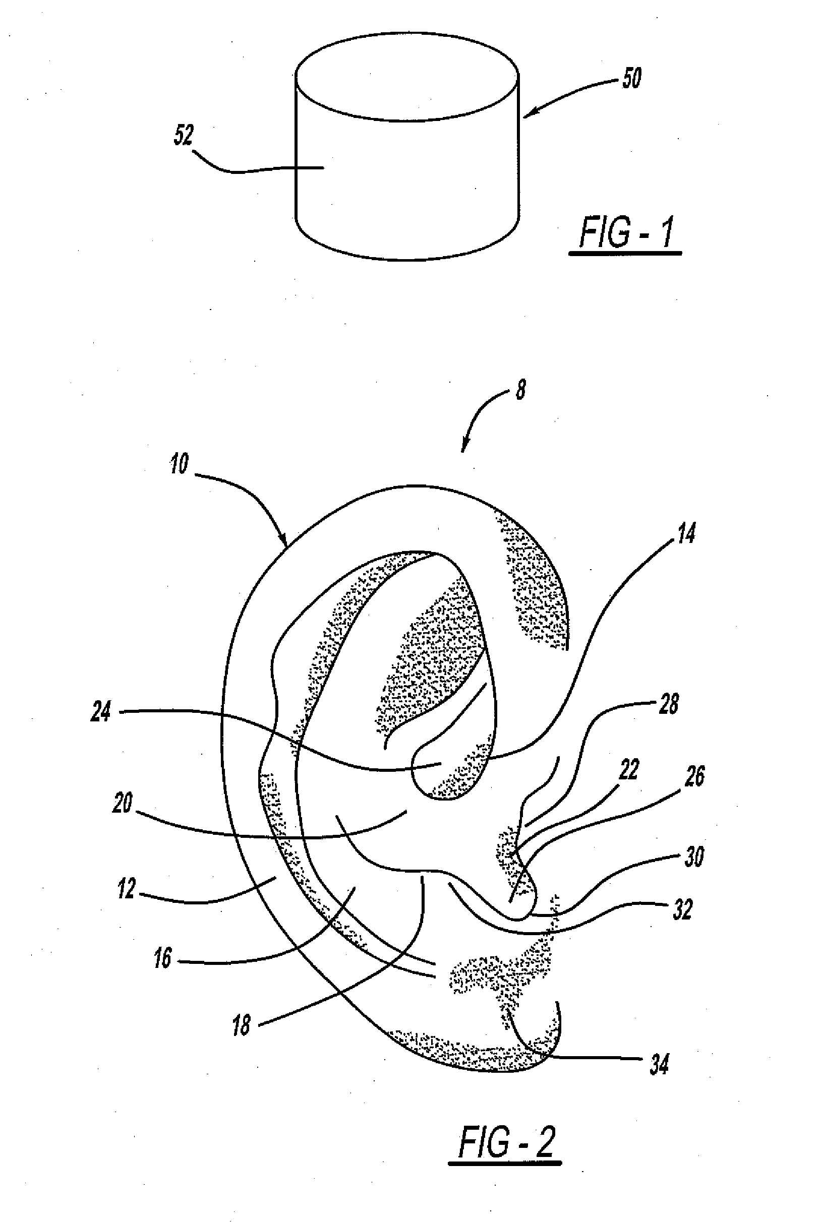 Apparatus and method of anchoring an ear piece