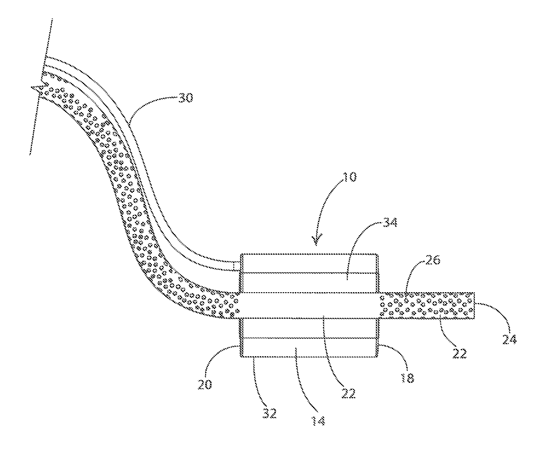 Device for use in endoluminal vacuum therapy