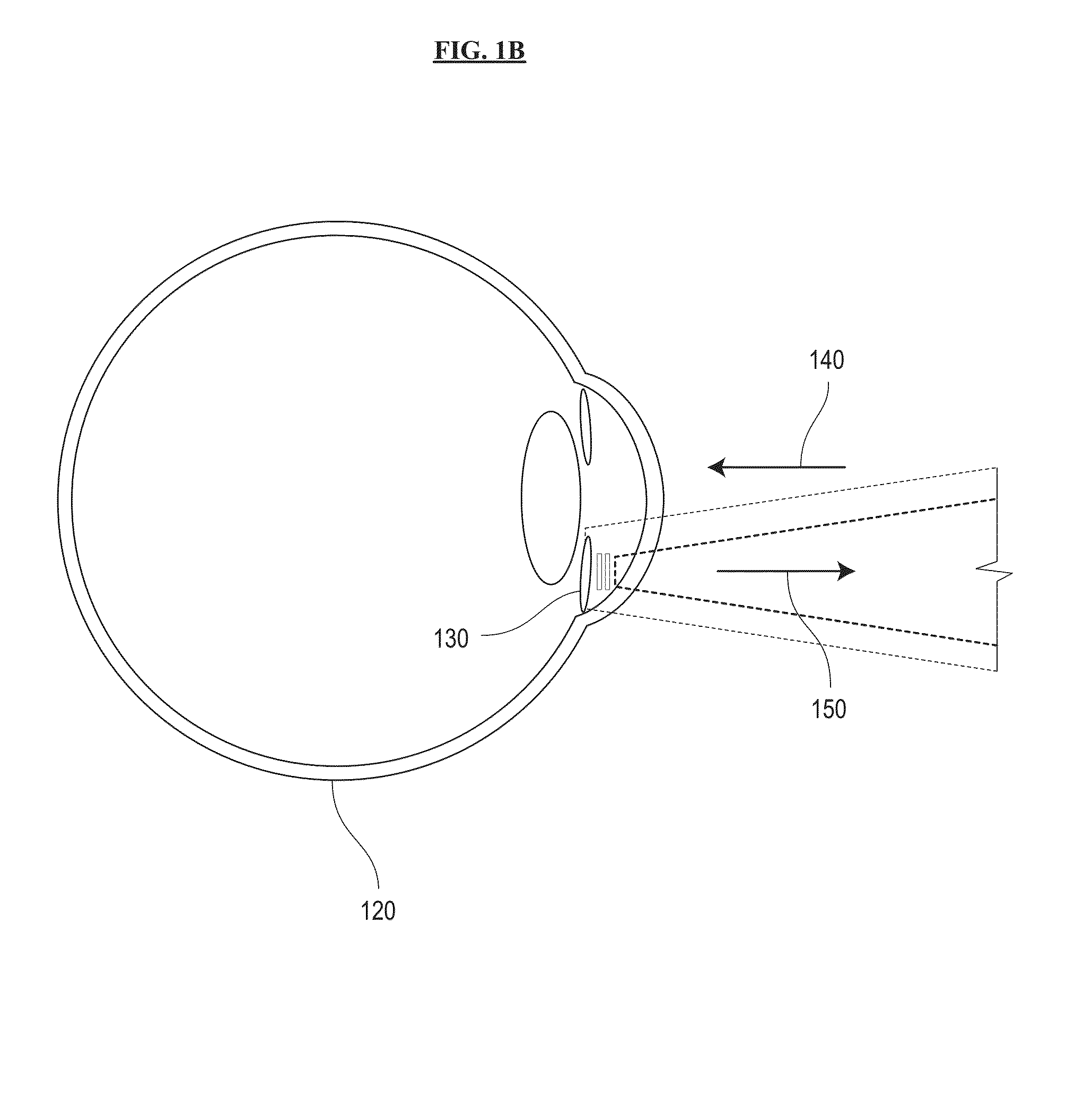 Systems and methods for sensing intraocular pressure