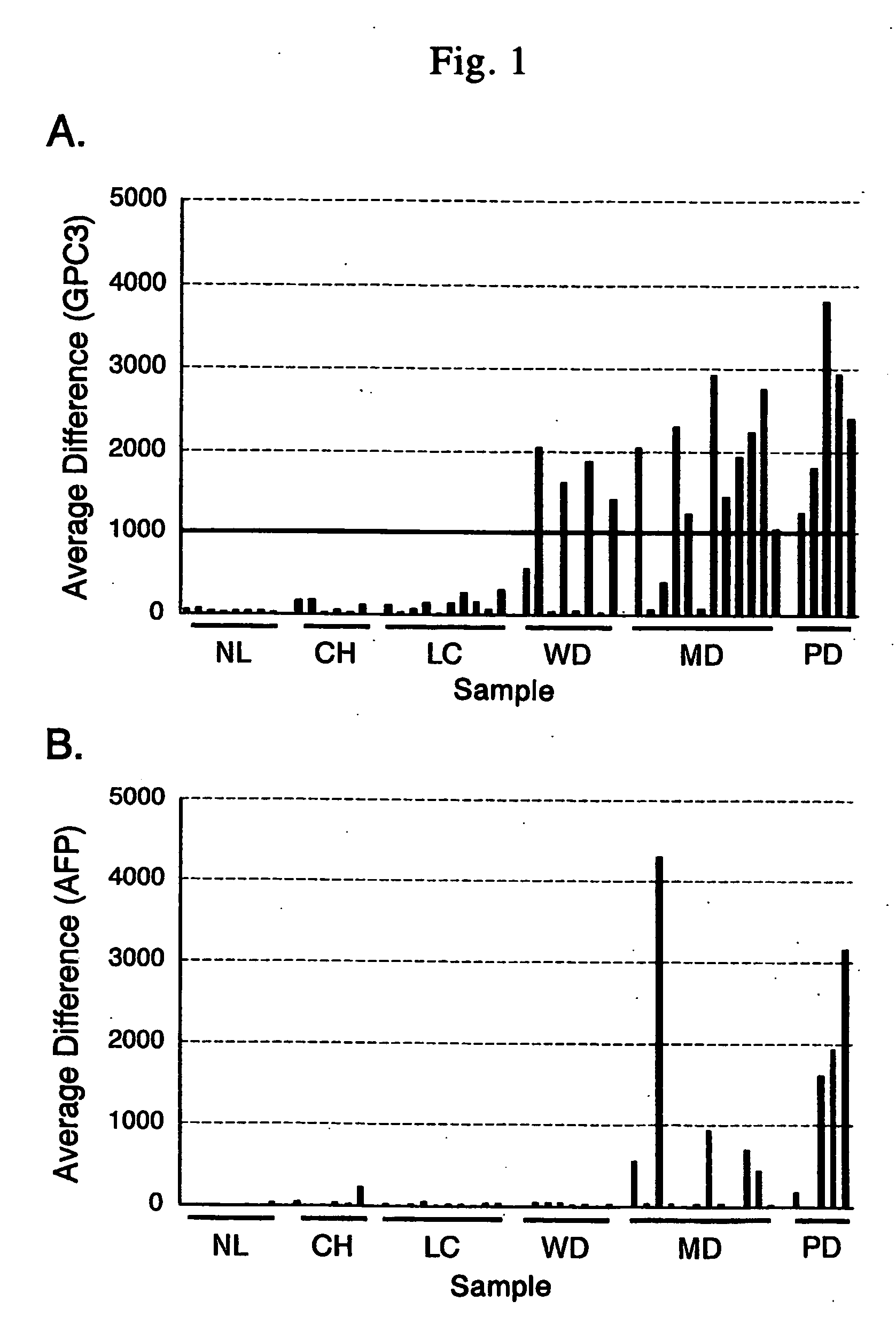 Antibody against n-terminal peptide or c-terminal peptide of gpc3 solubilized in blood