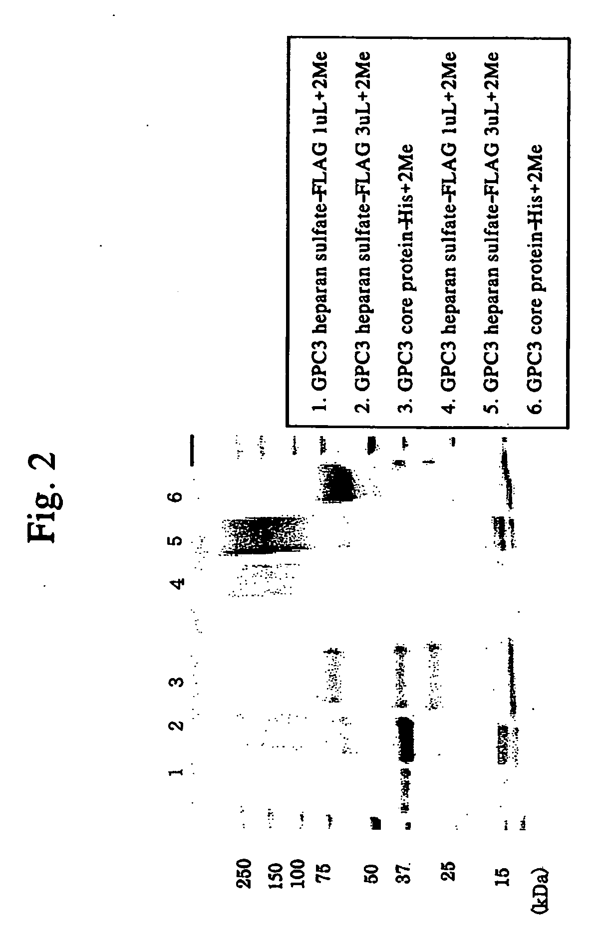 Antibody against n-terminal peptide or c-terminal peptide of gpc3 solubilized in blood