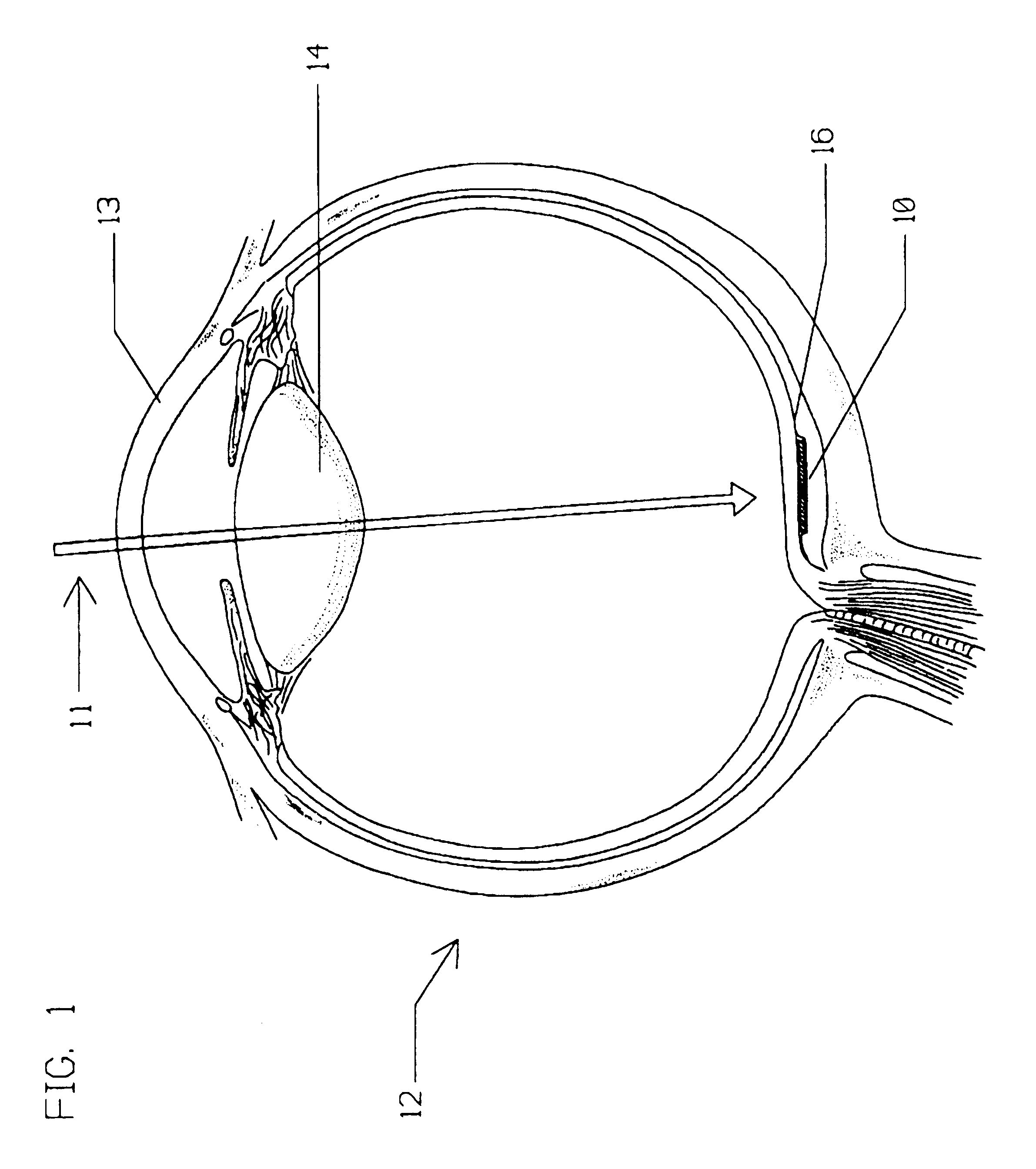 Multi-phasic microphotodetector retinal implant with variable voltage and current capability