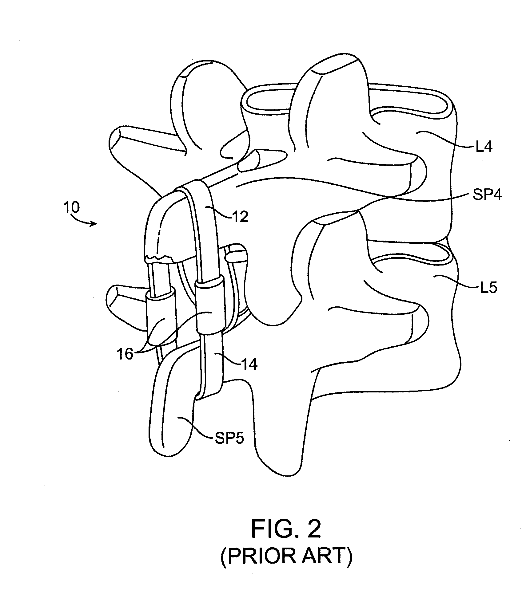 Structures and methods for constraining spinal processes with single connector