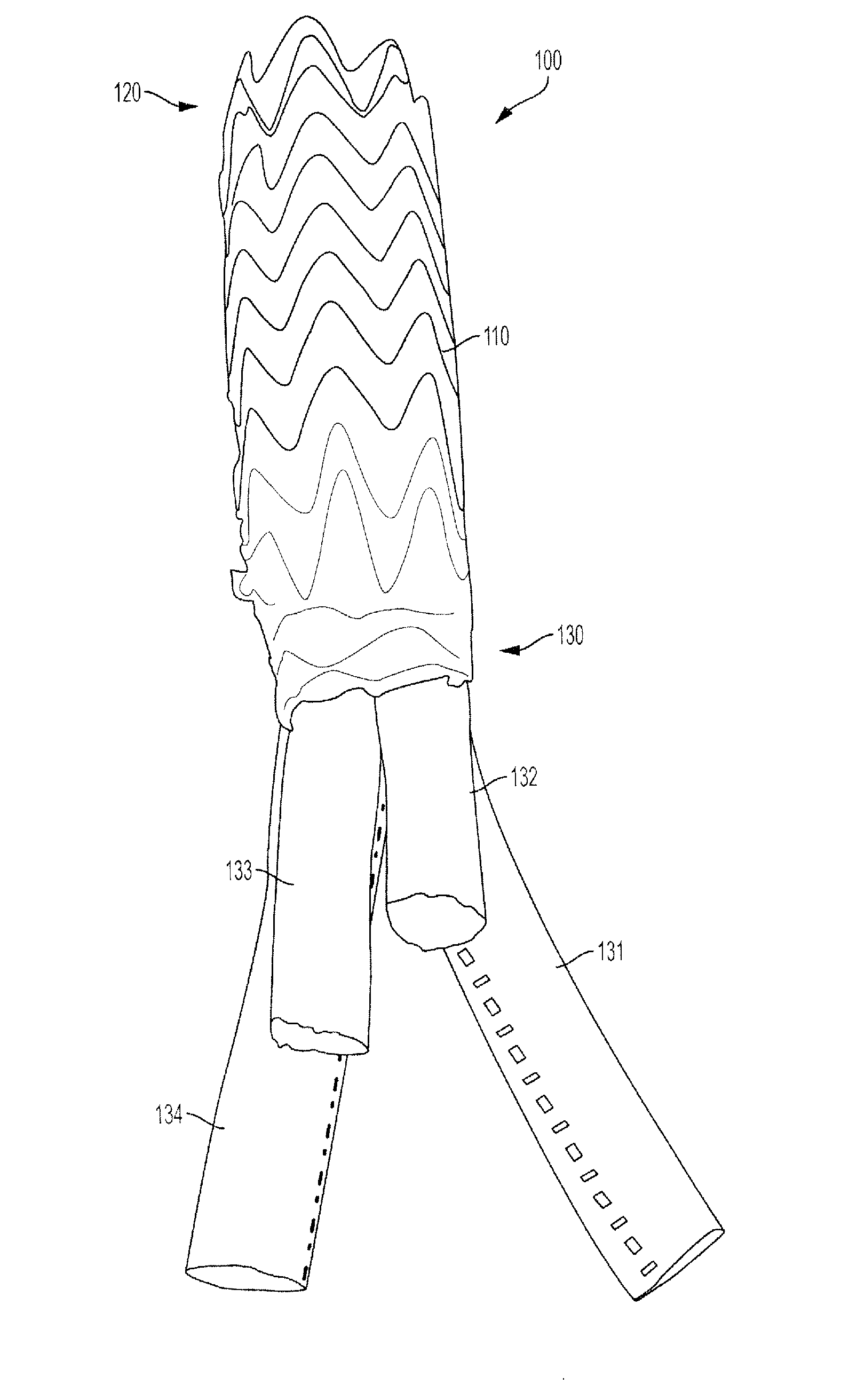 Universal Multi-Branch Endograft