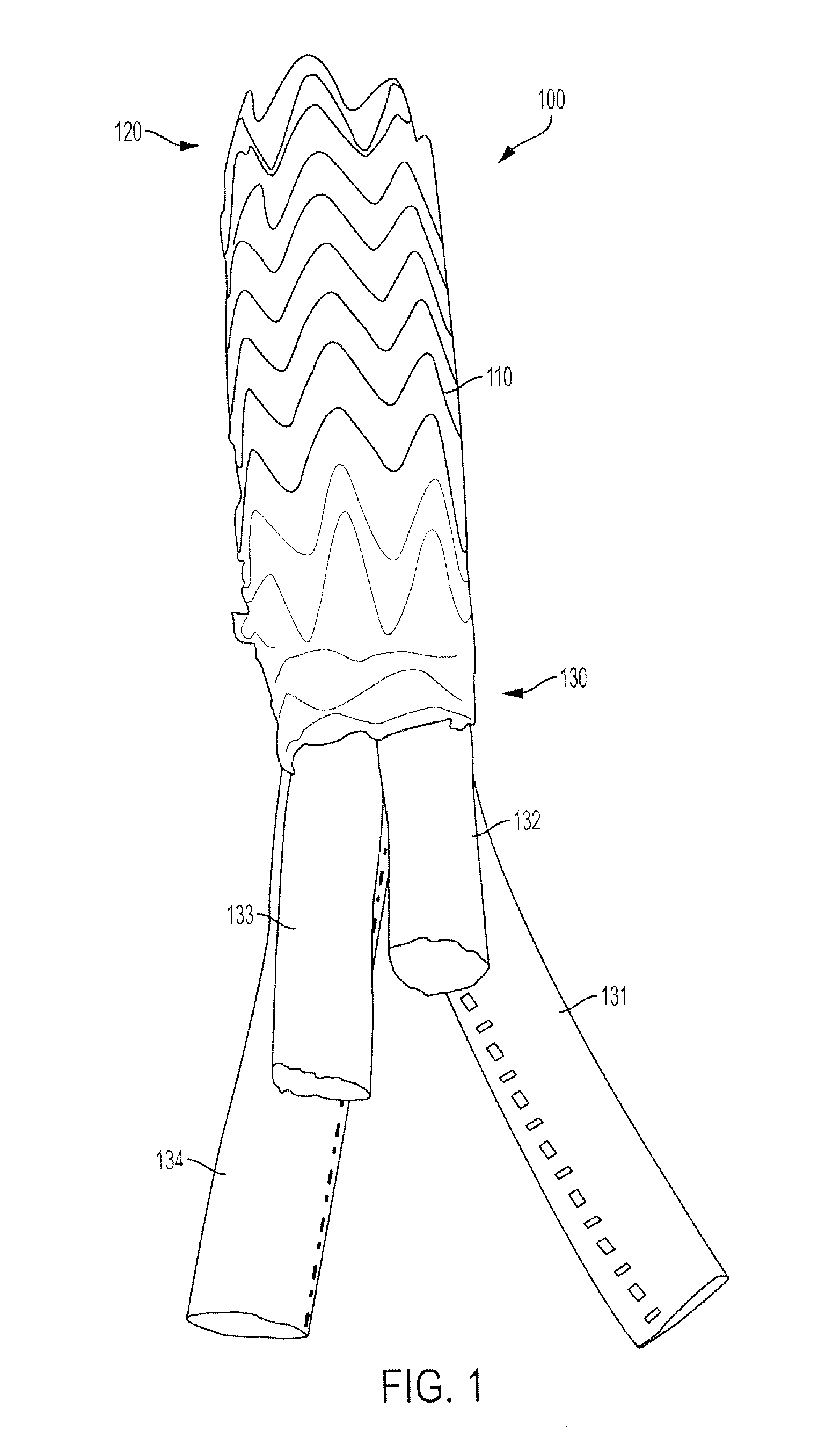 Universal Multi-Branch Endograft