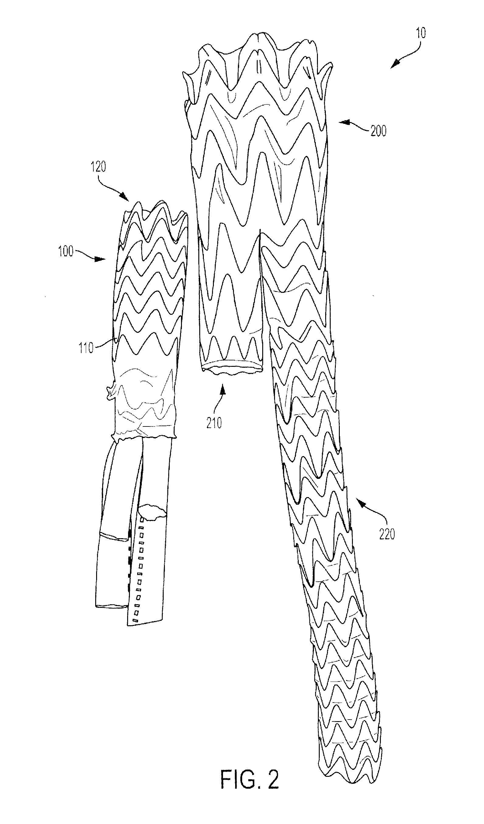 Universal Multi-Branch Endograft