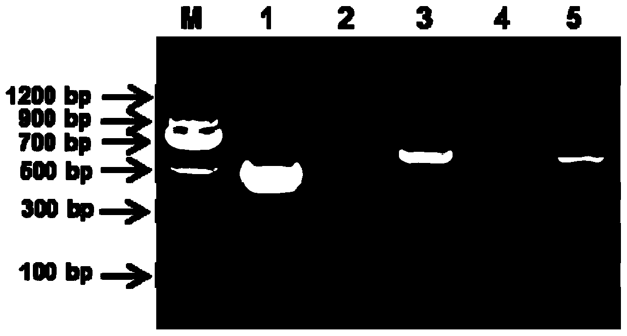 A kit for detecting chicken Newcastle disease virus of different genotypes