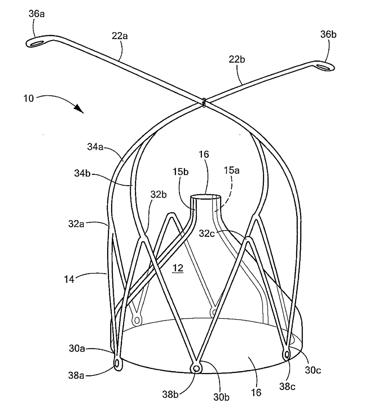 Transcatheter device and minimally invasive method for constricting and adjusting blood flow through a blood vessel