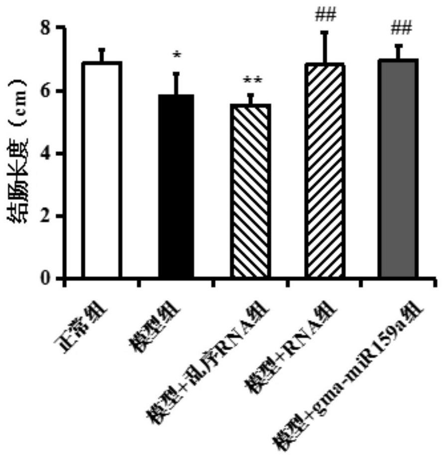 Application of soybean rna extract in the preparation of medicines for preventing and treating enteritis