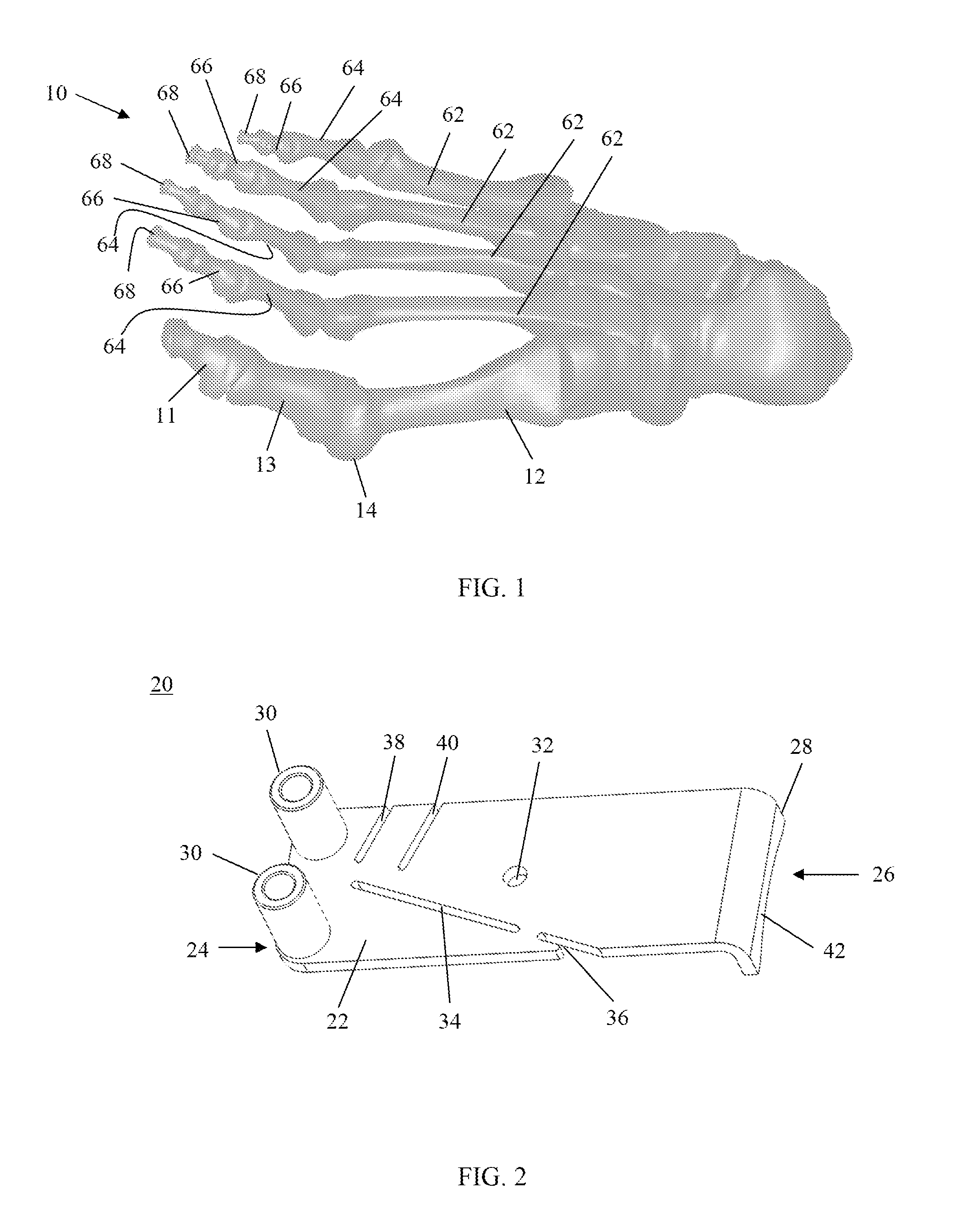 Resection guides, implants and methods
