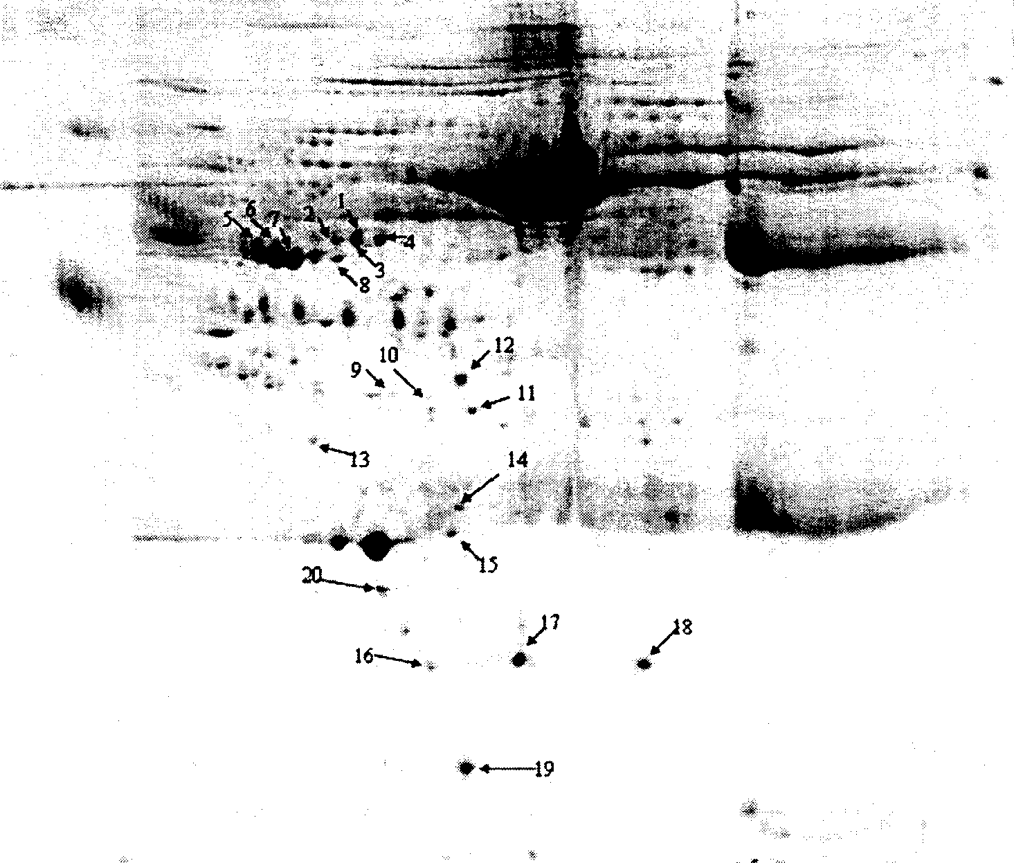 Method for acquiring plasma specific protein for schizophrenia diagnosis and use thereof