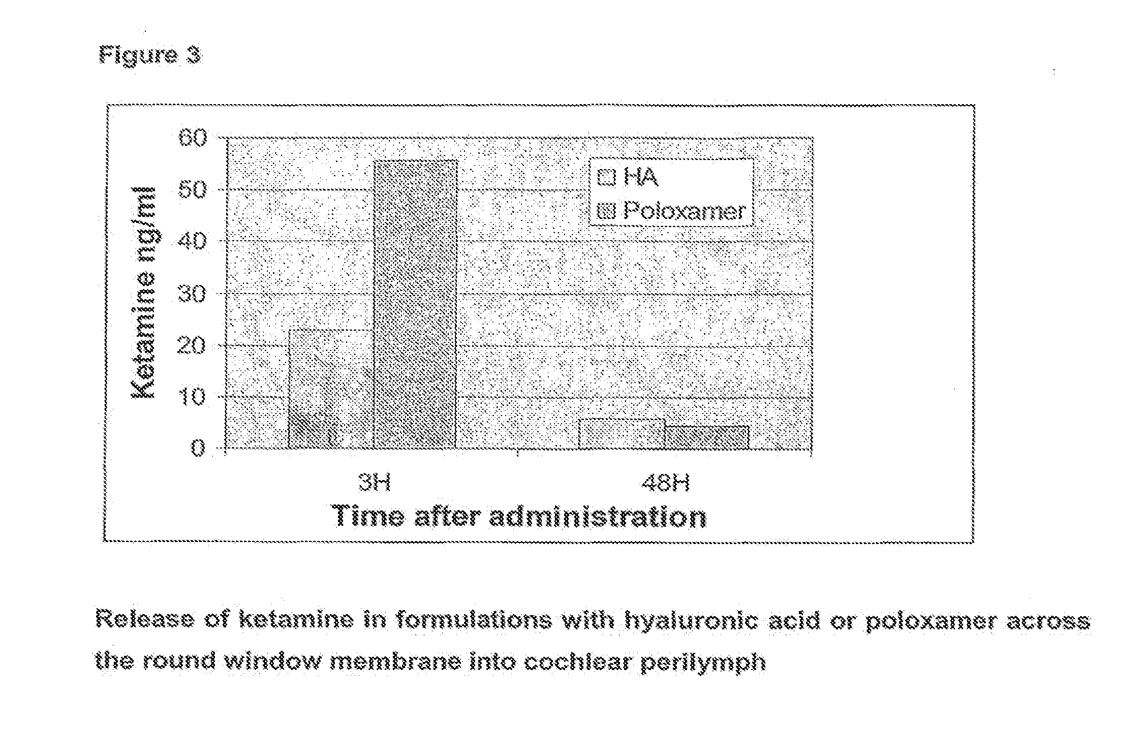 Pharmaceutical compositions for the treatment of inner ear disorders