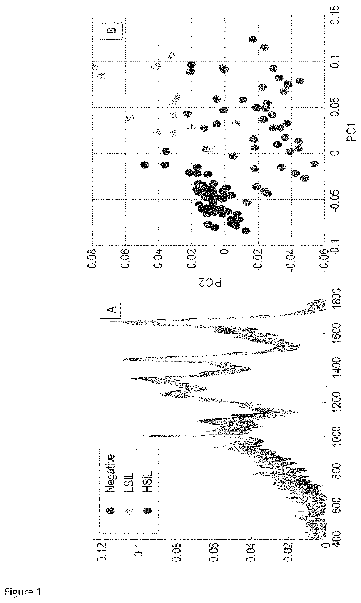 Method for identification of low grade cervical cytology cases likely to progress to high grade/cancer