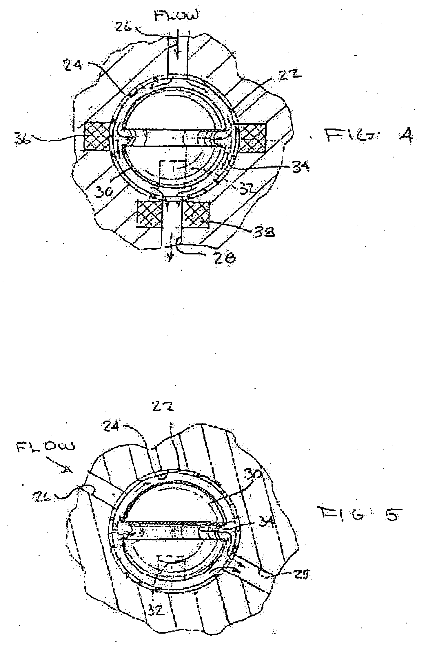 Shunt system including a flow control device for controlling the flow of cerebrospinal fluid out of a brain ventricle