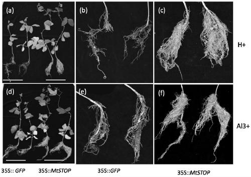 Alumite-stress transgenic soybean and application thereof