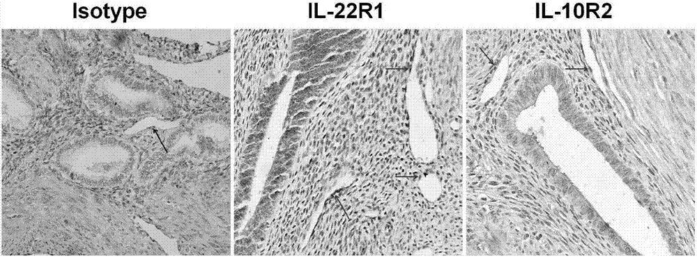 Application of interleukin (IL-22) antibody in preparing medicines for treating adenomyosis