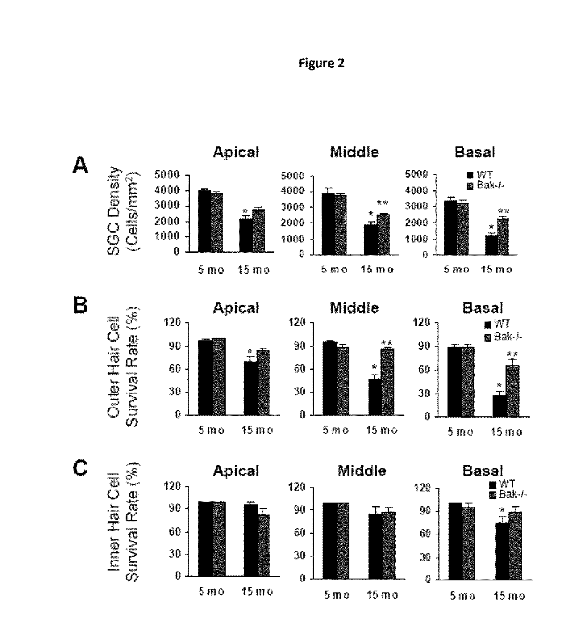 Compositions and methods for preventing and treating presbycusis