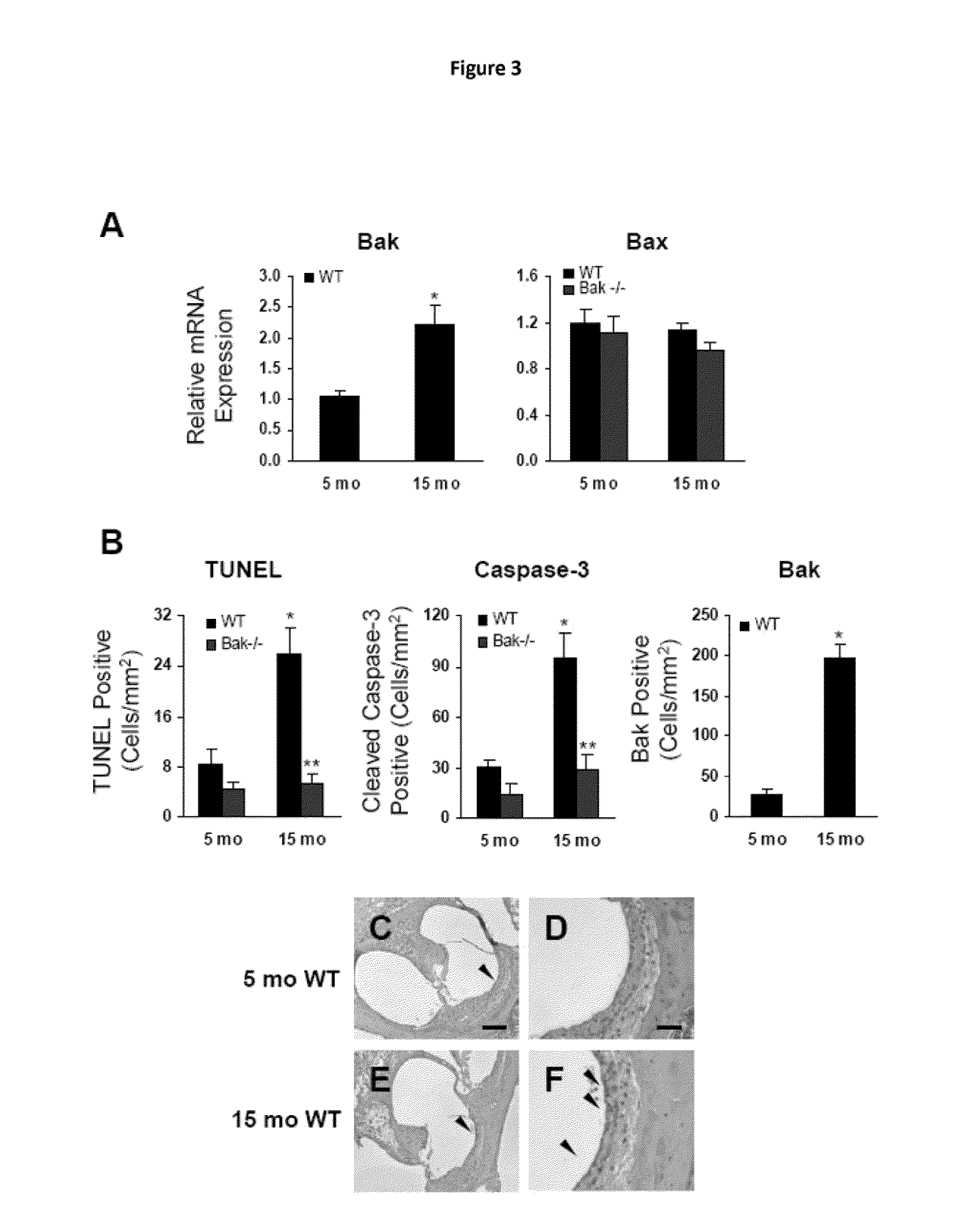 Compositions and methods for preventing and treating presbycusis
